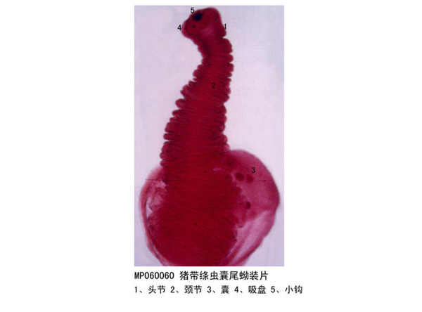 豬帶絳蟲(chóng)囊尾蚴裝片