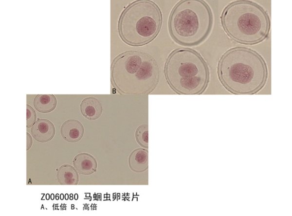 馬蛔蟲(chóng)卵裝片